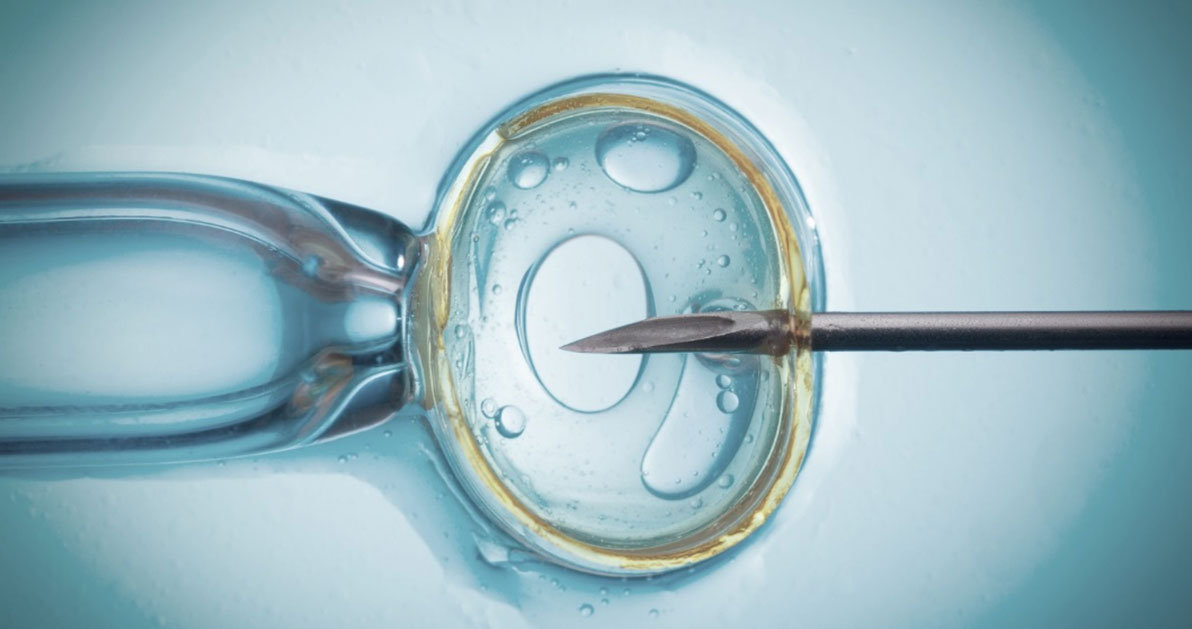 Análisis de KIR y HLA-C: estudio de infertilidad